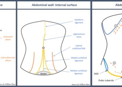 Flat & Fabulous: The Art of Tummy Tucks