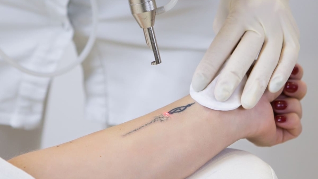 Understand The Process Of Laser Hair Removal